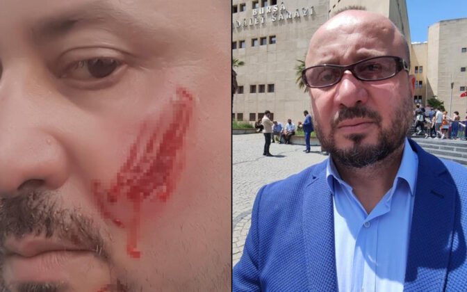 Bursa’da avukat hayatının şokunu yaşadı! Yanağını ısırıp parça kopardı!