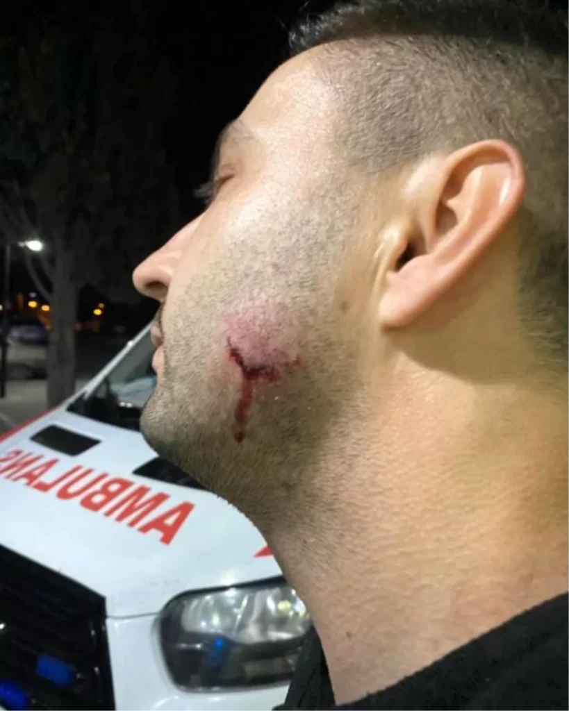 Ambulans Personeline Saldıran Jandarma Uzman Çavuş Açığa Alındı